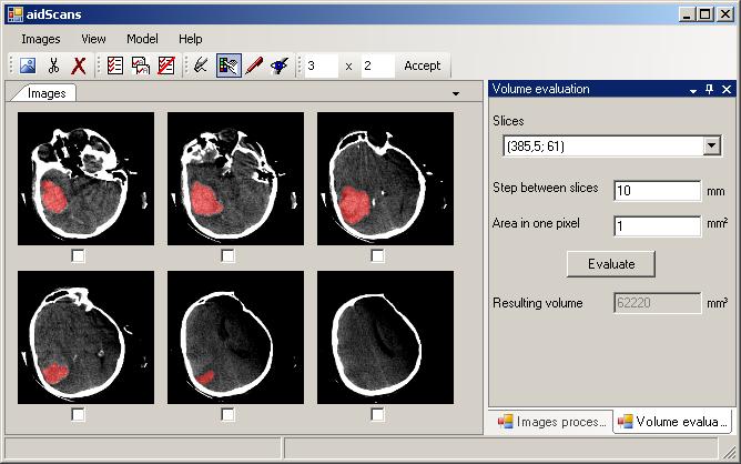 Click to view aidScans 4.7.1 screenshot